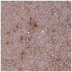 USP37, Rabbit, Polyclonal Antibody, Abnova 100 &mu;L | Buy Online | Abnova Corporation | Fisher Scientific