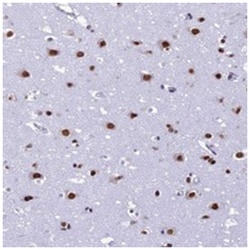 PRAMEF12, Rabbit, Polyclonal Antibody, Abnova 100 &mu;L | Buy Online | Abnova Corporation | Fisher Scientific