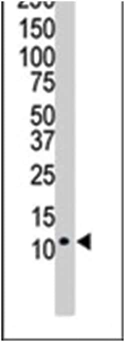 UBB Rabbit anti-Human, Polyclonal Antibody, Abnova 400 &mu;L | Buy Online | Abnova Corporation | Fisher Scientific