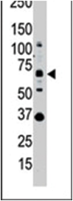 SENP1 Rabbit anti-Human, Polyclonal Antibody, Abnova 400 &mu;L | Buy Online | Abnova Corporation | Fisher Scientific