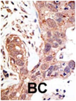SENP1 Rabbit anti-Human, Polyclonal Antibody, Abnova 400 &mu;L | Buy Online | Abnova Corporation | Fisher Scientific