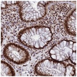 AP5Z1, Rabbit, Polyclonal Antibody, Abnova 100&mu;L; Unlabeled:Antibodies,