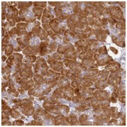 RPL13A, Rabbit, Polyclonal Antibody, Abnova 100&mu;L; Unlabeled:Antibodies,