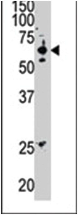 SENP2 Rabbit anti-Human, Mouse, Polyclonal Antibody, Abnova 400&mu;L; Unlabeled:Antibodies,