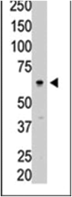 SENP3, Rabbit, Polyclonal Antibody, Abnova 400 &mu;L | Buy Online | Abnova Corporation | Fisher Scientific