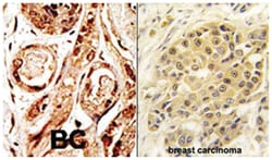 SENP3, Rabbit, Polyclonal Antibody, Abnova 400 &mu;L | Buy Online | Abnova Corporation | Fisher Scientific