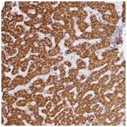 SLC38A9, Rabbit, Polyclonal Antibody, Abnova 100&mu;L; Unlabeled:Antibodies,