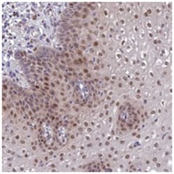 ANKRD52, Rabbit, Polyclonal Antibody, Abnova 100 &mu;L | Buy Online | Abnova | Fisher Scientific