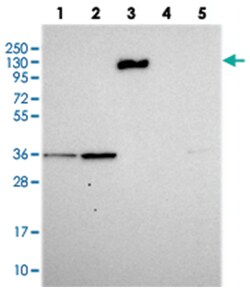 C6, Rabbit, Polyclonal Antibody, Abnova 100 &mu;L | Buy Online | Abnova Corporation | Fisher Scientific