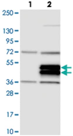 TRIML2, Rabbit, Polyclonal Antibody, Abnova 100 &mu;L | Buy Online | Abnova Corporation | Fisher Scientific