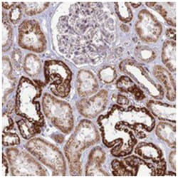 SLC35F4, Rabbit, Polyclonal Antibody, Abnova 100 &mu;L | Buy Online | Abnova Corporation | Fisher Scientific