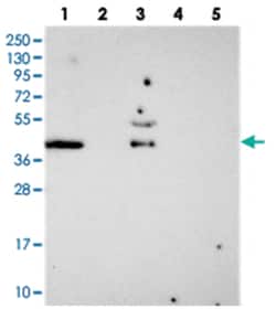 FAM113B, Rabbit, Polyclonal Antibody, Abnova 100 &mu;L | Buy Online | Abnova Corporation | Fisher Scientific