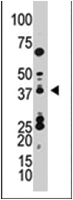 SUMO4 Rabbit anti-Human, Polyclonal Antibody, Abnova 400 &mu;L | Buy Online | Abnova Corporation | Fisher Scientific
