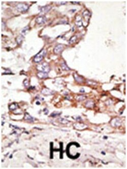 SUMO4 Rabbit anti-Human, Polyclonal Antibody, Abnova 400 &mu;L | Buy Online | Abnova Corporation | Fisher Scientific