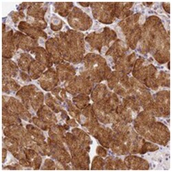 RHBDD3 Rabbit anti-Human, Polyclonal Antibody, Abnova 100 &mu;L | Buy Online | Abnova Corporation | Fisher Scientific