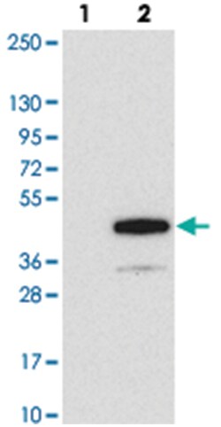 RHBDD3 Rabbit anti-Human, Polyclonal Antibody, Abnova 100 &mu;L | Buy Online | Abnova Corporation | Fisher Scientific