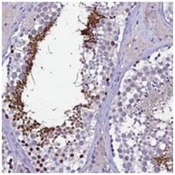 C2orf51, Rabbit, Polyclonal Antibody, Abnova 100 &mu;L | Buy Online | Abnova Corporation | Fisher Scientific