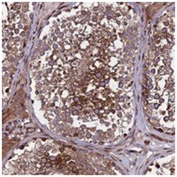 WWC2, Rabbit, Polyclonal Antibody, Abnova 100 &mu;L | Buy Online | Abnova | Fisher Scientific