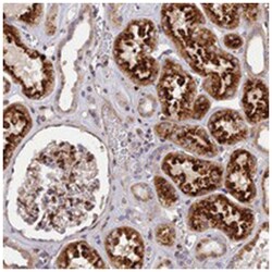 CPSF4L, Rabbit, Polyclonal Antibody, Abnova 100&mu;L; Unlabeled:Anticuerpos