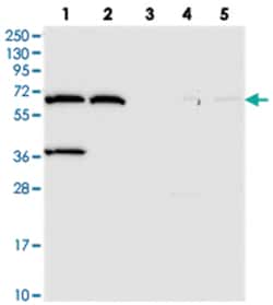 ADAMTSL5, Rabbit, Polyclonal Antibody, Abnova 100 &mu;L | Buy Online | Abnova Corporation | Fisher Scientific