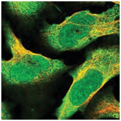 TSPYL2 Rabbit anti-Human, Polyclonal Antibody, Abnova 100&mu;L; Unlabeled:Antibodies,