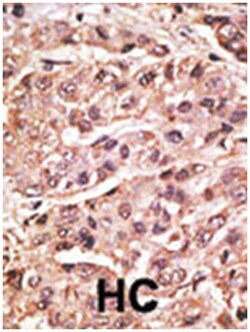 SUMO4 Rabbit anti-Human, Polyclonal Antibody, Abnova 400 &mu;L | Buy Online | Abnova Corporation | Fisher Scientific
