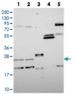 NUDT16L1, Rabbit, Polyclonal Antibody, Abnova 100&mu;L; Unlabeled:Antibodies,