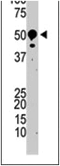 SUV39H2 Rabbit anti-Human, Polyclonal Antibody, Abnova 400 &mu;L | Buy Online | Abnova Corporation | Fisher Scientific