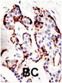 SUV39H2 Rabbit anti-Human, Polyclonal Antibody, Abnova 400 &mu;L | Buy Online | Abnova Corporation | Fisher Scientific