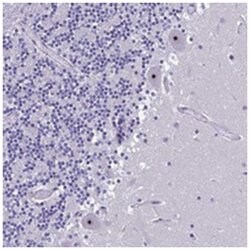 NOC2L, Rabbit, Polyclonal Antibody, Abnova 100 &mu;L | Buy Online | Abnova | Fisher Scientific
