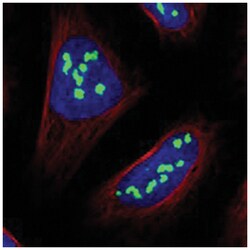 NOC2L, Rabbit, Polyclonal Antibody, Abnova 100 &mu;L | Buy Online | Abnova | Fisher Scientific
