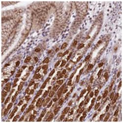 TMEM104, Rabbit, Polyclonal Antibody, Abnova 100&mu;L; Unlabeled:Antibodies,