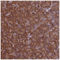 C17orf39, Rabbit, Polyclonal Antibody, Abnova 100&mu;L; Unlabeled:Antibodies,