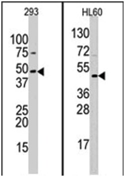 SUV39H2 Rabbit anti-Human, Polyclonal Antibody, Abnova 400 &mu;L | Buy Online | Abnova Corporation | Fisher Scientific