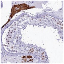 DHX40, Rabbit, Polyclonal Antibody, Abnova 100&mu;L; Unlabeled:Antibodies,