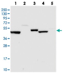 UAP1L1, Rabbit, Polyclonal Antibody, Abnova 100 &mu;L | Buy Online | Abnova Corporation | Fisher Scientific