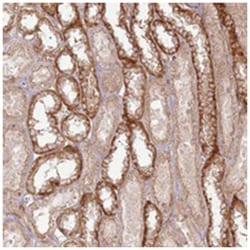 ZNF623, Rabbit, Polyclonal Antibody, Abnova 100 &mu;L | Buy Online | Abnova Corporation | Fisher Scientific