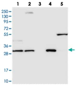LACTB2, Rabbit, Polyclonal Antibody, Abnova 100&mu;L; Unlabeled:Antibodies,