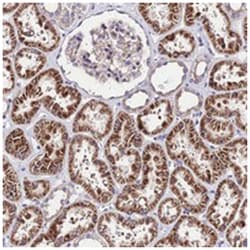 LACTB2, Rabbit, Polyclonal Antibody, Abnova 100&mu;L; Unlabeled:Antibodies,