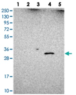 UTP23, Rabbit, Polyclonal Antibody, Abnova 100&mu;L; Unlabeled:Antibodies,