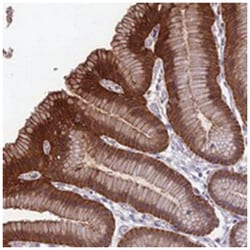 RTN4RL1, Rabbit, Polyclonal Antibody, Abnova 100 &mu;L | Buy Online | Abnova Corporation | Fisher Scientific