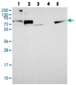 NOL8, Rabbit, Polyclonal Antibody, Abnova 100 &mu;L | Buy Online | Abnova Corporation | Fisher Scientific