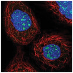NOL8, Rabbit, Polyclonal Antibody, Abnova 100 &mu;L | Buy Online | Abnova Corporation | Fisher Scientific