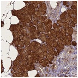 STATH, Rabbit, Polyclonal Antibody, Abnova 100 &mu;L | Buy Online | Abnova Corporation | Fisher Scientific