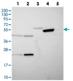 TIGD6, Rabbit, Polyclonal Antibody, Abnova 100 &mu;L | Buy Online | Abnova Corporation | Fisher Scientific