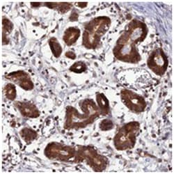 C11orf10, Rabbit, Polyclonal Antibody, Abnova 100 &mu;L | Buy Online | Abnova Corporation | Fisher Scientific
