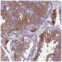 SLC26A10, Rabbit, Polyclonal Antibody, Abnova 100 &mu;L | Buy Online | Abnova | Fisher Scientific