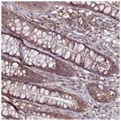 GSPT2, Rabbit, Polyclonal Antibody, Abnova 100 &mu;L | Buy Online | Abnova Corporation | Fisher Scientific