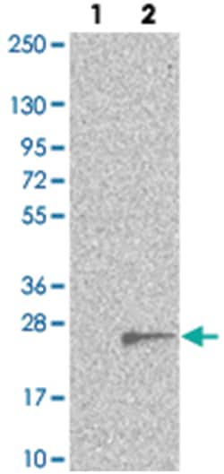 TMEM97, Rabbit, Polyclonal Antibody, Abnova 100 &mu;L | Buy Online | Abnova Corporation | Fisher Scientific
