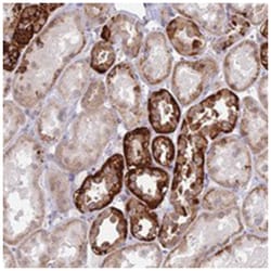 C6orf163, Rabbit, Polyclonal Antibody, Abnova 100 &mu;L | Buy Online | Abnova Corporation | Fisher Scientific